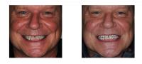 Choose Your Smile - Dr. Stephen Malfair image 6